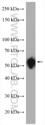 SDCCAG3 Antibody in Western Blot (WB)