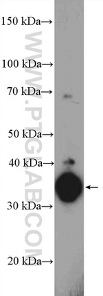 EBP2 Antibody in Western Blot (WB)