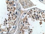 TELO2 Antibody in Immunohistochemistry (Paraffin) (IHC (P))