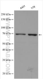 TELO2 Antibody in Western Blot (WB)