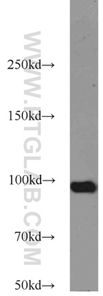 TELO2 Antibody in Western Blot (WB)