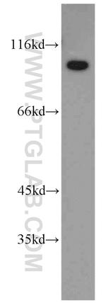 TELO2 Antibody in Western Blot (WB)