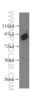 TELO2 Antibody in Western Blot (WB)