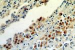 ISG15 Antibody in Immunohistochemistry (Paraffin) (IHC (P))