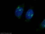 PSMB3 Antibody in Immunocytochemistry (ICC/IF)