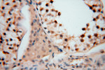 PSMB3 Antibody in Immunohistochemistry (Paraffin) (IHC (P))