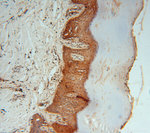 PSMB3 Antibody in Immunohistochemistry (Paraffin) (IHC (P))