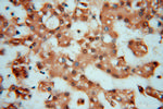 PSMB3 Antibody in Immunohistochemistry (Paraffin) (IHC (P))