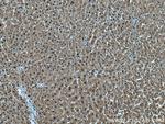 PSMB3 Antibody in Immunohistochemistry (Paraffin) (IHC (P))