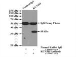 KCNJ15 Antibody in Immunoprecipitation (IP)