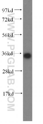 KCNJ15 Antibody in Western Blot (WB)