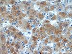 BAAT Antibody in Immunohistochemistry (Paraffin) (IHC (P))