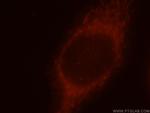 CCT7 Antibody in Immunocytochemistry (ICC/IF)