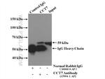 CCT7 Antibody in Immunoprecipitation (IP)