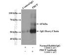 PRCP Antibody in Immunoprecipitation (IP)