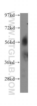 PRCP Antibody in Western Blot (WB)