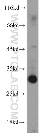 ANT1/2 Antibody in Western Blot (WB)