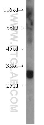 ANT1/2 Antibody in Western Blot (WB)