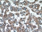 ATP5F1 Antibody in Immunohistochemistry (Paraffin) (IHC (P))