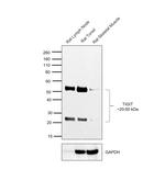 TIGIT Antibody