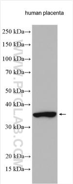 FGL1 Antibody in Western Blot (WB)