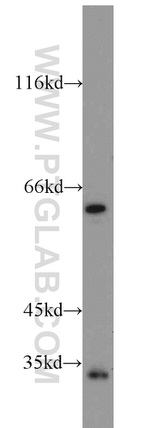 FGL1 Antibody in Western Blot (WB)