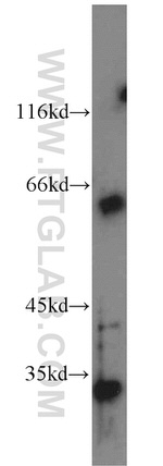 FGL1 Antibody in Western Blot (WB)