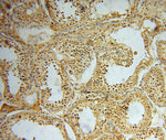 ARG1 Antibody in Immunohistochemistry (Paraffin) (IHC (P))