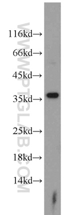 ARG1 Antibody in Western Blot (WB)