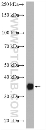 ARG1 Antibody in Western Blot (WB)