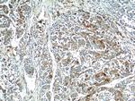 ARG1 Antibody in Immunohistochemistry (Paraffin) (IHC (P))