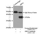 ARG1 Antibody in Immunoprecipitation (IP)