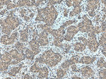 NBR1 Antibody in Immunohistochemistry (Paraffin) (IHC (P))