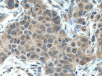 NBR1 Antibody in Immunohistochemistry (Paraffin) (IHC (P))