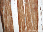 NBR1 Antibody in Immunohistochemistry (Paraffin) (IHC (P))