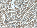 NBR1 Antibody in Immunohistochemistry (Paraffin) (IHC (P))