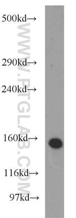 NBR1 Antibody in Western Blot (WB)