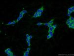 PLA2G12A Antibody in Immunocytochemistry (ICC/IF)