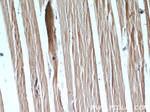 PLA2G12A Antibody in Immunohistochemistry (Paraffin) (IHC (P))