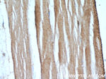 PLA2G12A Antibody in Immunohistochemistry (Paraffin) (IHC (P))