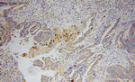 PLA2G12A Antibody in Immunohistochemistry (Paraffin) (IHC (P))