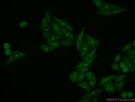 LAS1L Antibody in Immunocytochemistry (ICC/IF)