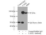 LAS1L Antibody in Immunoprecipitation (IP)