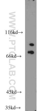 LAS1L Antibody in Western Blot (WB)