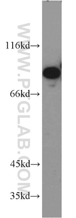 LAS1L Antibody in Western Blot (WB)