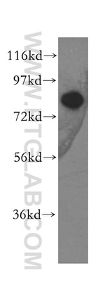 LAS1L Antibody in Western Blot (WB)