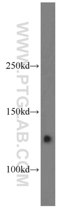 CYFIP1/2 Antibody in Western Blot (WB)