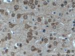 CYFIP1/2 Antibody in Immunohistochemistry (Paraffin) (IHC (P))