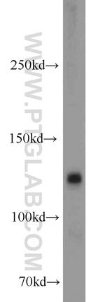 CYFIP1/2 Antibody in Western Blot (WB)