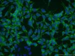 TRAPPC9 Antibody in Immunocytochemistry (ICC/IF)